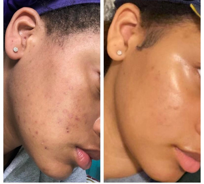 Organic Turmeric Facial Cleansing Bar