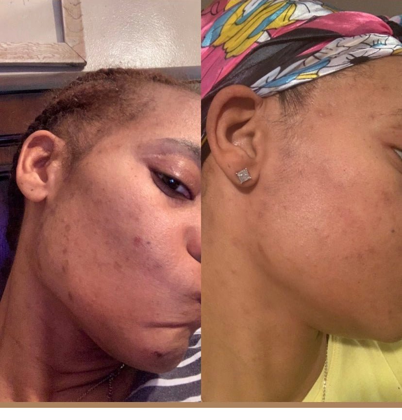 Organic Turmeric Facial Cleansing Bar